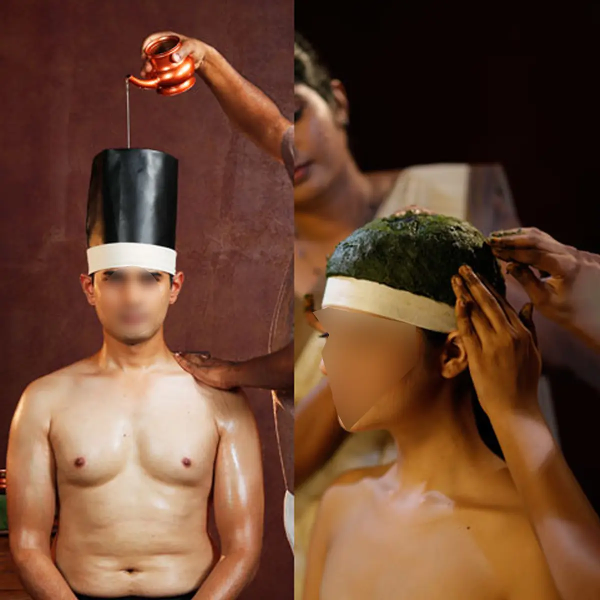 shirovasti clinic in dubai - Kottakkal ayurveda speciality clinic